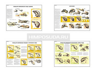 Плакаты ПРОФТЕХ &quot;Акушерская помощь коровам при патологических отелах&quot; (4 пл, винил, 70х100) 